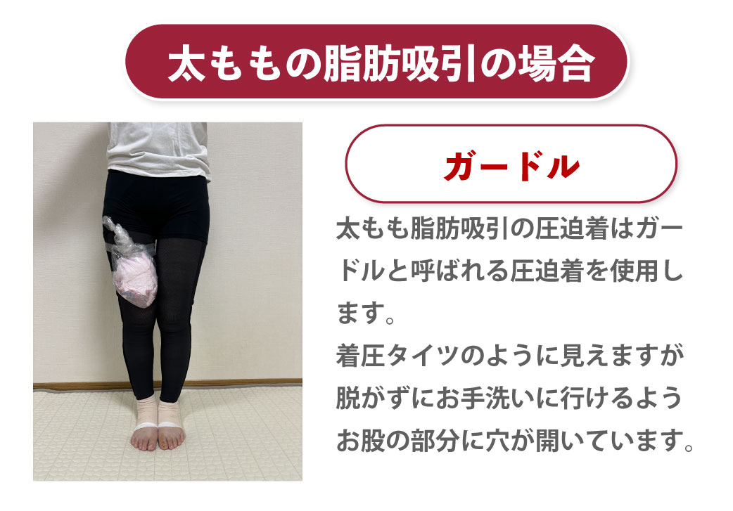 脂肪吸引の圧迫はいつまですればいい？しなかった場合はどうなるのかも